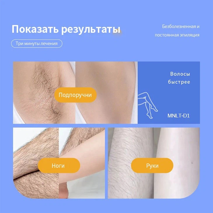 лазерная удаление волос красивые женщины
